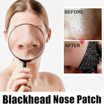 Nose Blackhead Strips